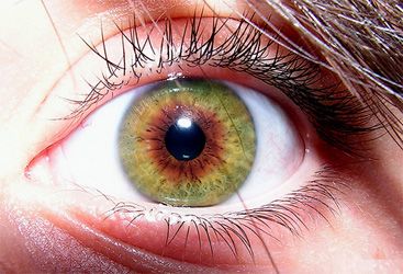 Risco de Glaucoma aumenta com diagnóstico de hipertensão e diabetes