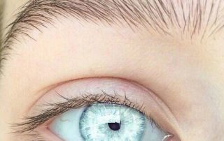 Descolamento de Retina é um problema de visão grave que ocorre quando a parte sensorial da retina se descola da camada vascular, responsável por nutrir e irrigar a região.