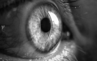 Ceratocone e Exercícios Visuais: 4 Dúvidas Frequentes Sobre o Tema